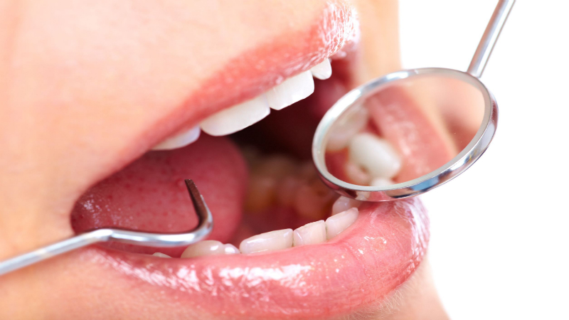 Cosmetic Dentist In Sydney: Why Visit