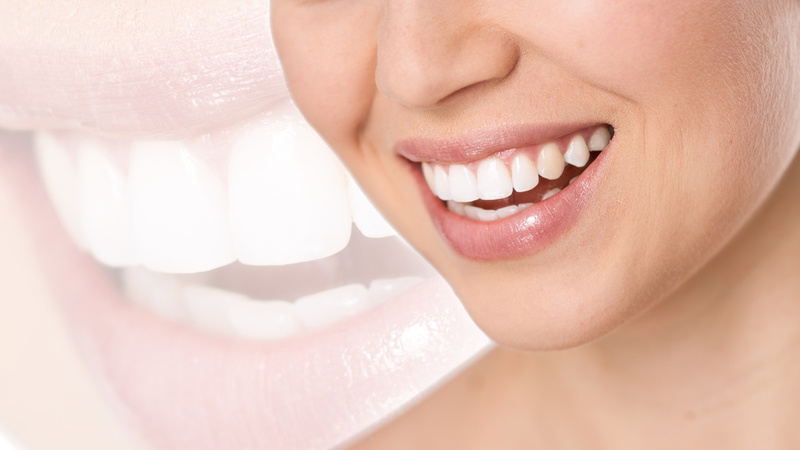 What Should Patients Know About Implant Dentistry Services in Vancouver, WA?