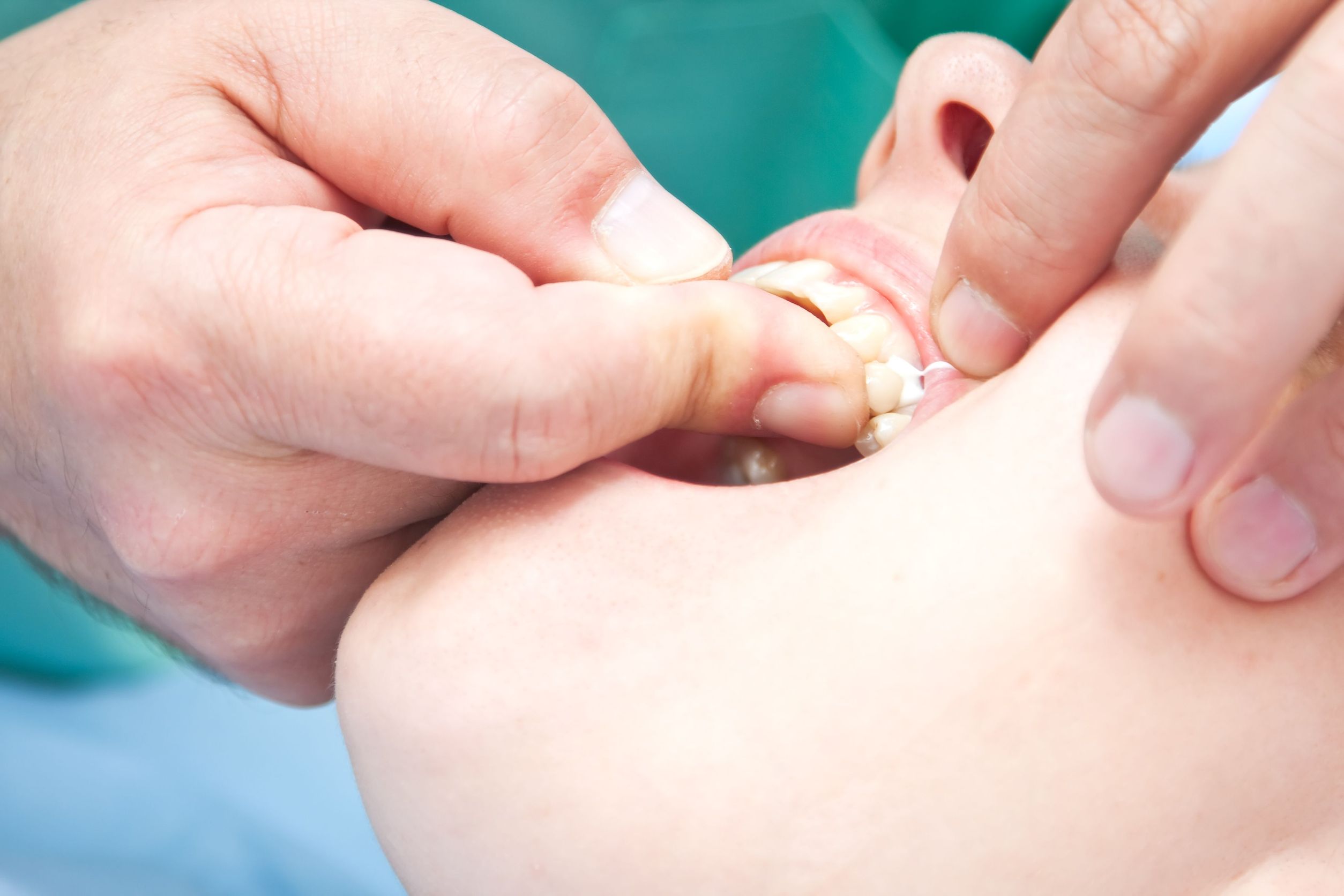 Top Reasons You Will Want to See an Oral Surgeon in Evanston, IL
