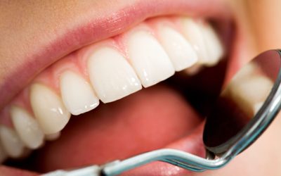Solutions for Healthy Teeth Provided by a General Dentist Parker, CO Patients Prefer